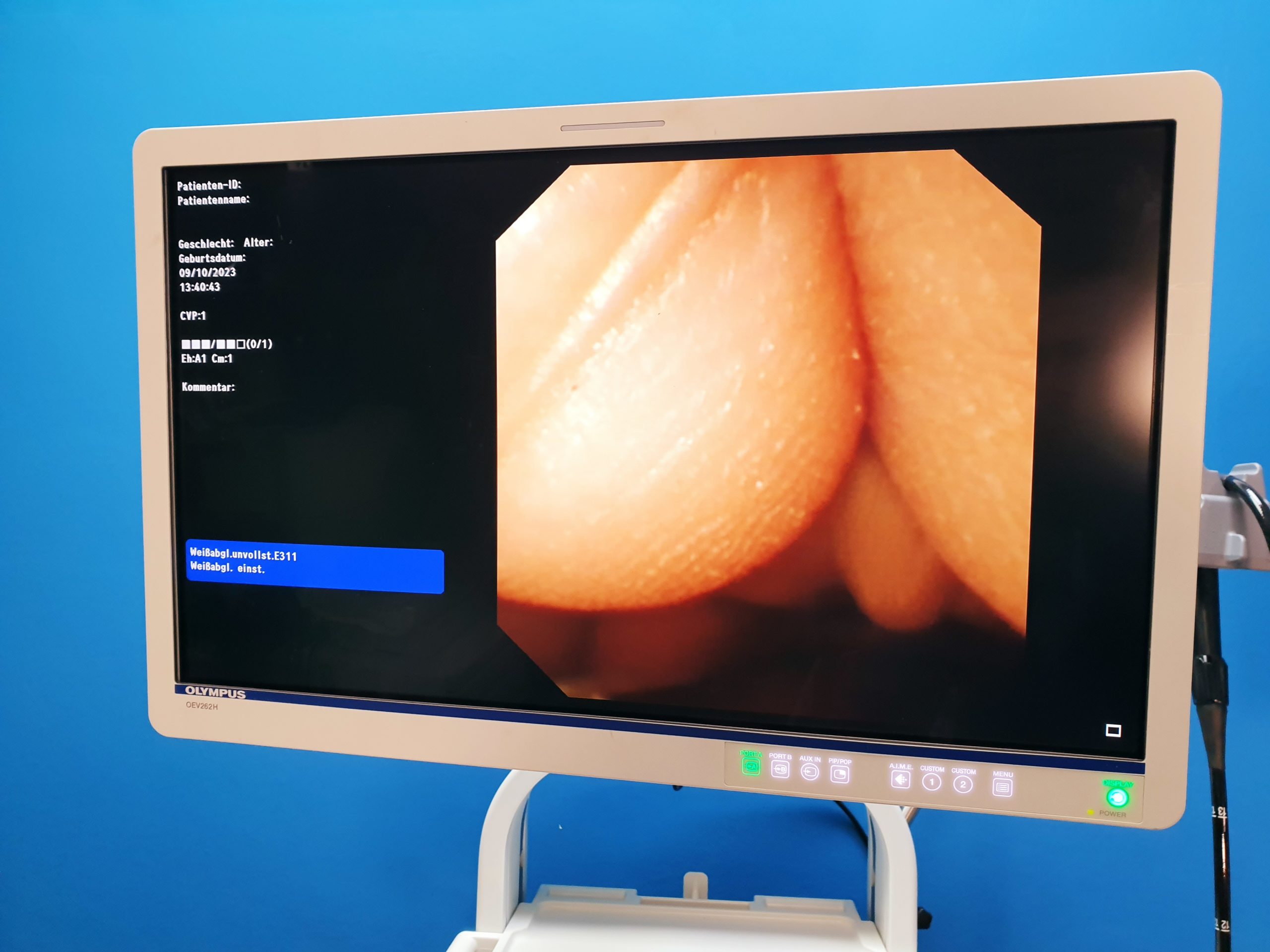OLYMPUS URF-Videourethoroscope Uretheroskop