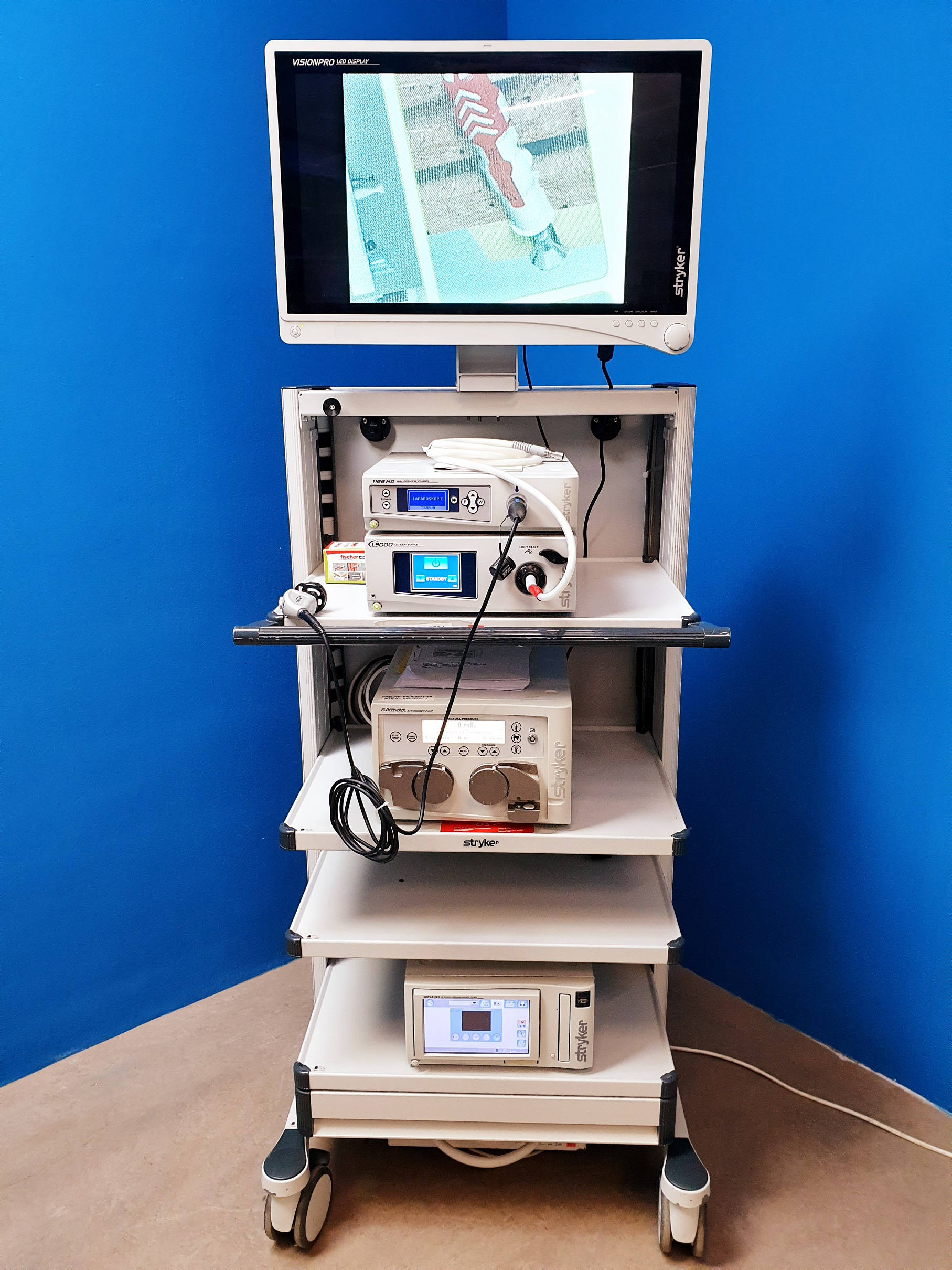 Stryker Turm Arthroskopie Laparaskopie Zystoskopie – 1188HD – L9000 LED Light Source – Stryker FLOCONTROL Arthroskopie Pump – VISIONPRO LED Display – SDC Ultra HD Managment System –