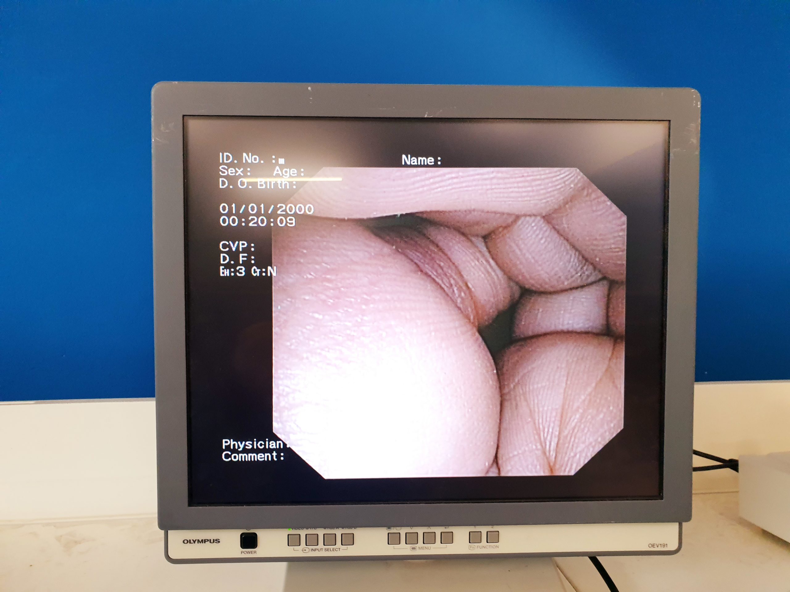 Olympus CV-160 Ecv-160 Evis Exera Video Processor