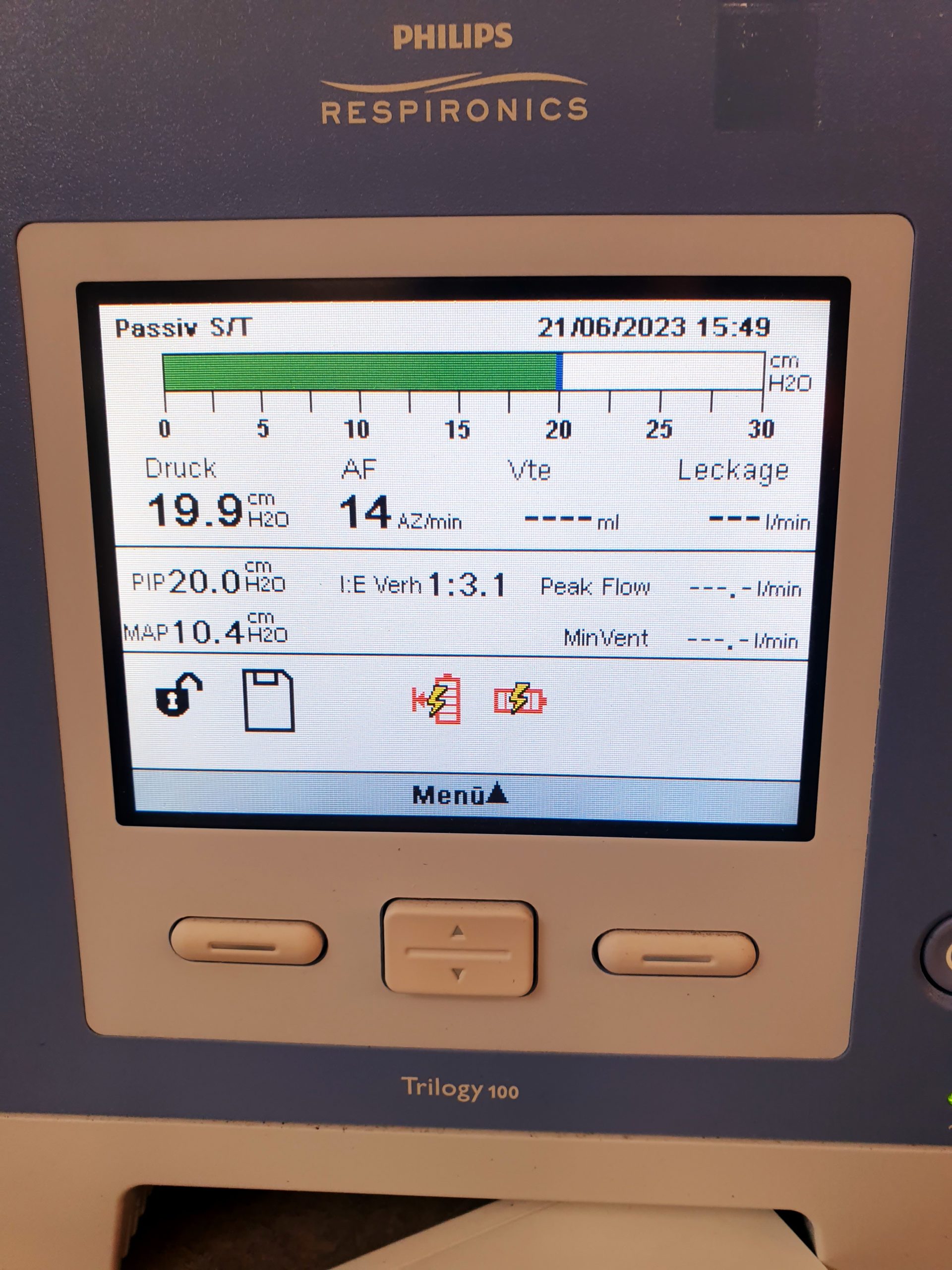 Philips Respironics Trilogy 100 Ventilator
