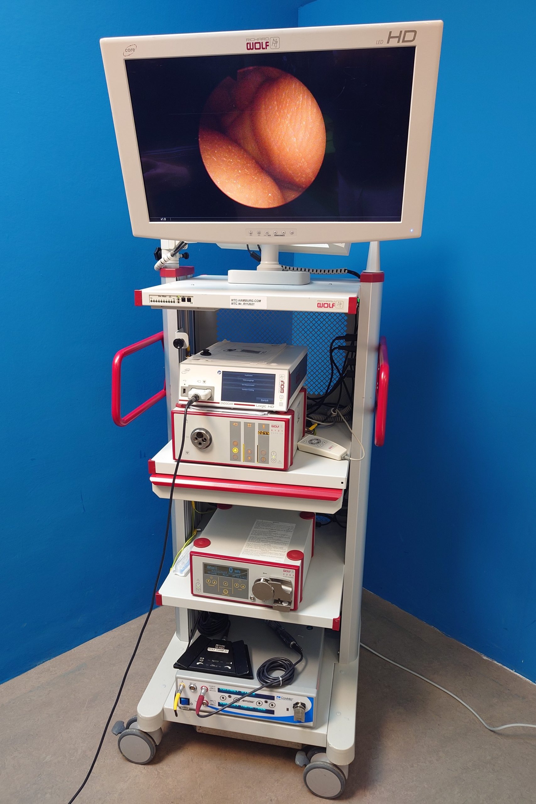 Arthroskopie Turm: Richard Wolf Endocam Logic HD Core + Richard Wolf 5131 Auto LP Lichtquelle + Richard Wolf 2203 Elektrothermisches Arthroskopie-system Conmed Advantage D3000 + Conmed Ergo Handstck + HD led 26 Zoll Monitor
