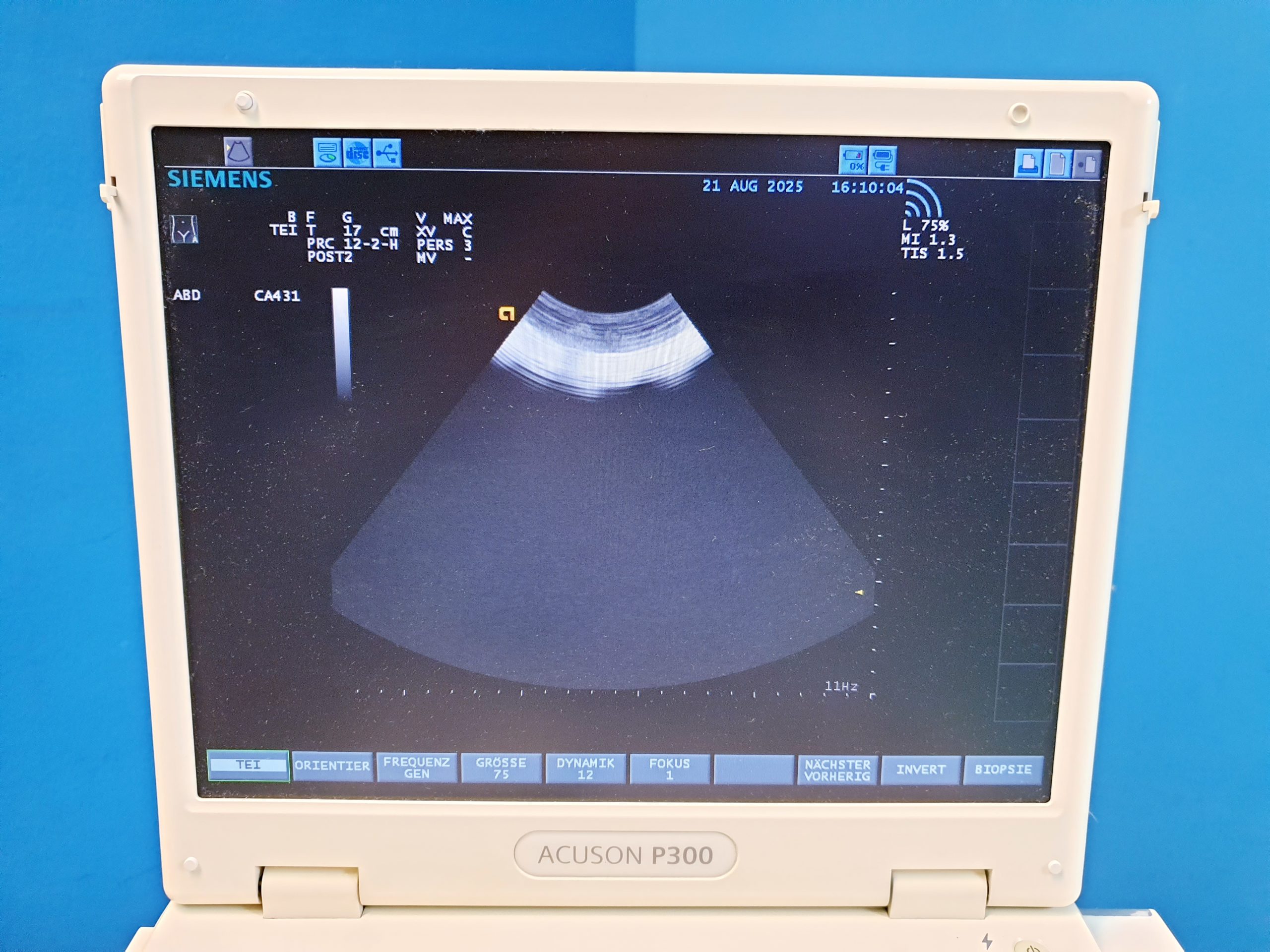 Siemens CA431 Ultraschallsonde