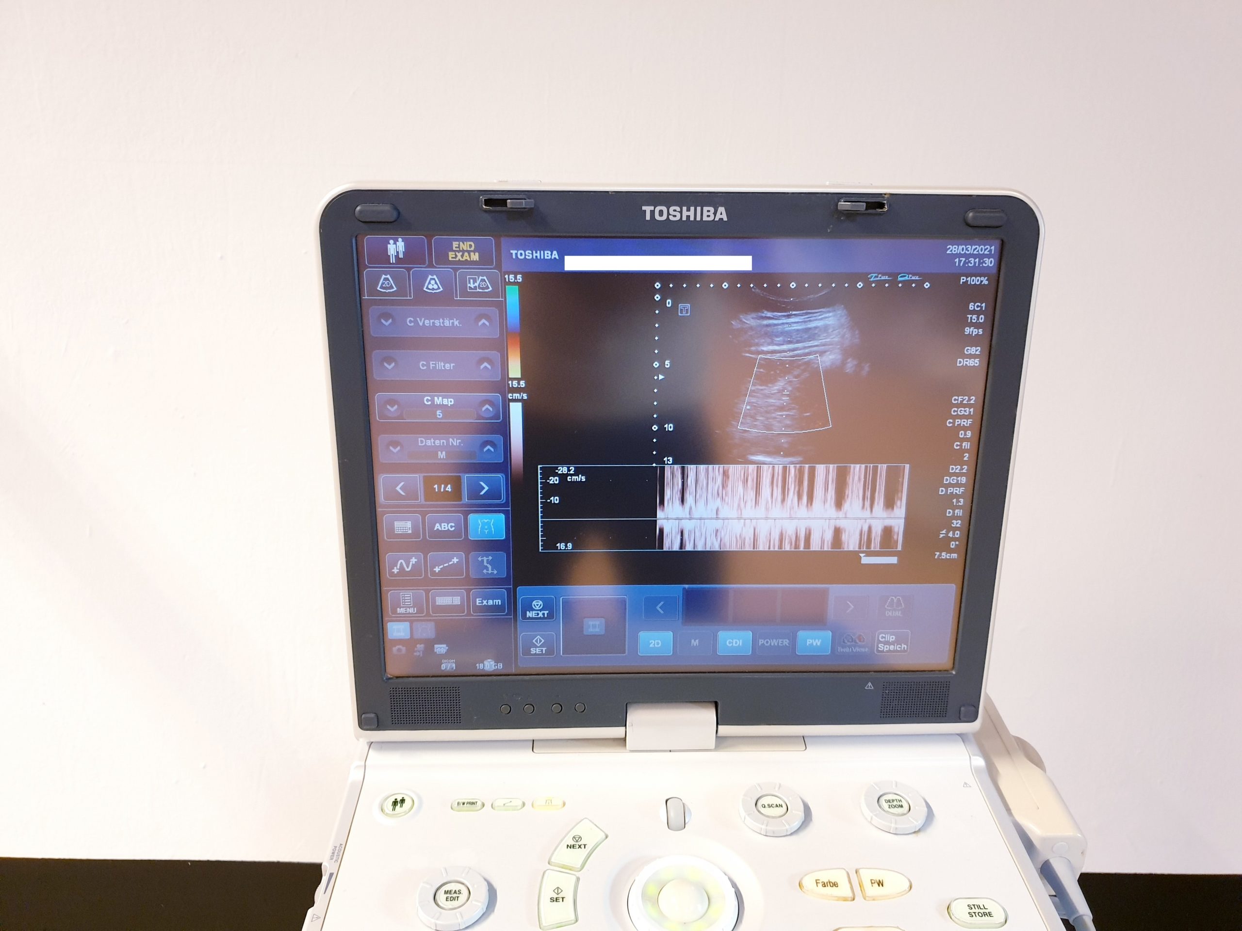 Toshiba Viamo mit PVT-375ST // PVT 375 ST Konvex Probe, Printer Farhrbar