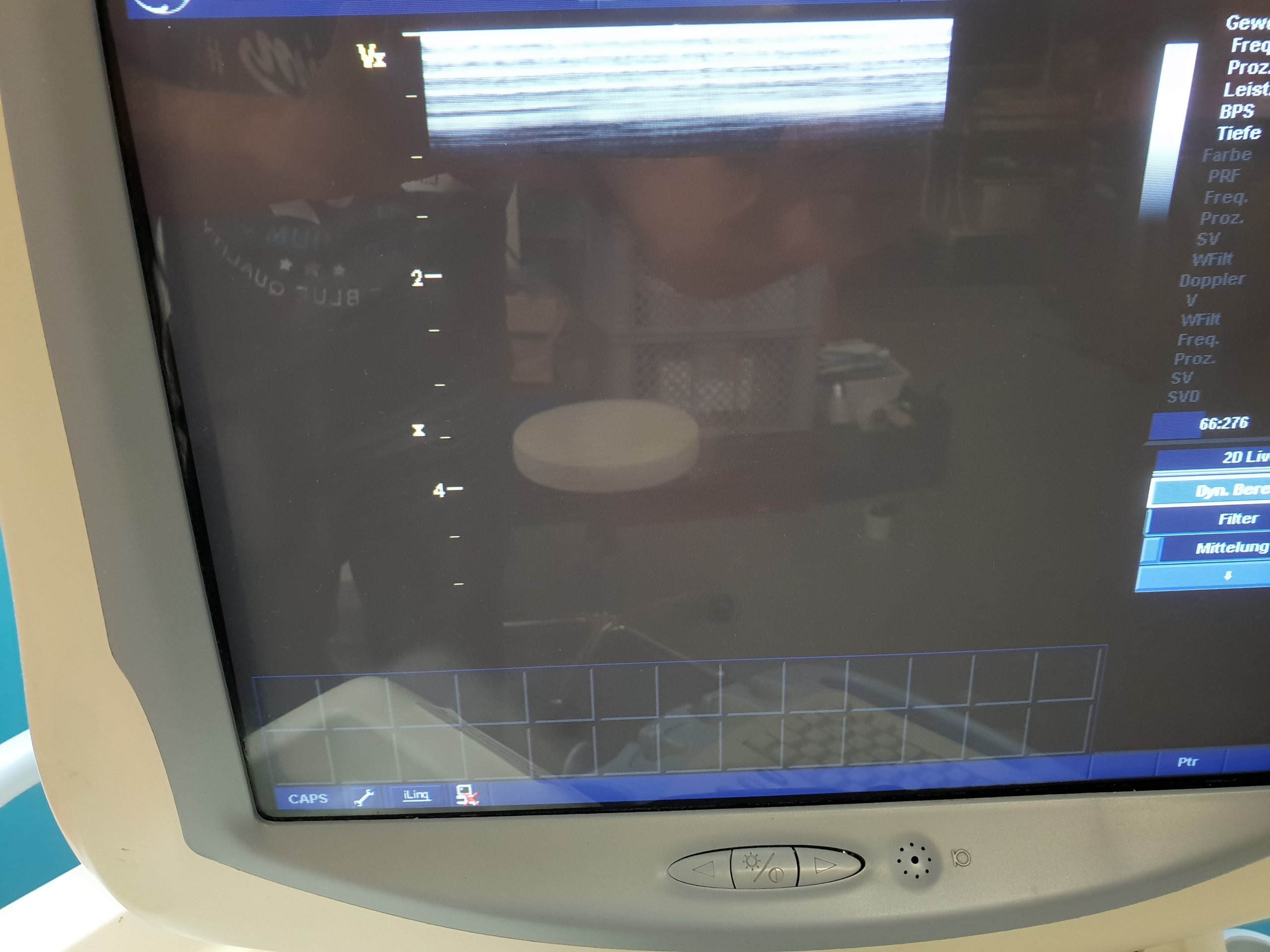 GE Vivid 7 Dimension Ultraschallgerät mit 3 Sonden, Printer und Videorekorder