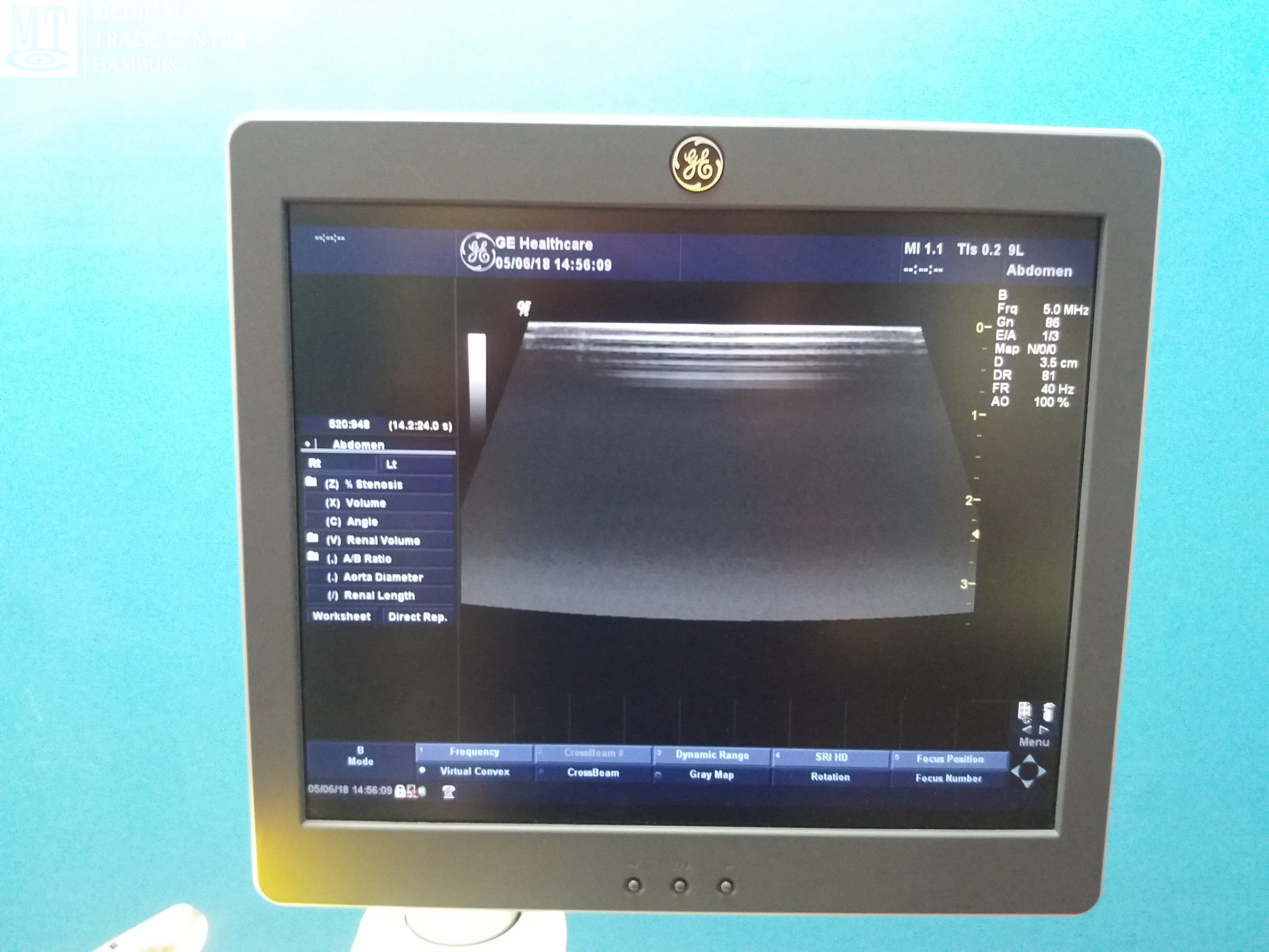 GE Medical 9L Ultraschallsonde // Probe Bj 2013