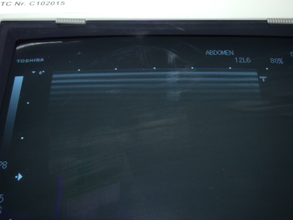 TOSHIBA PLQ-805A Ultrasound Transducer