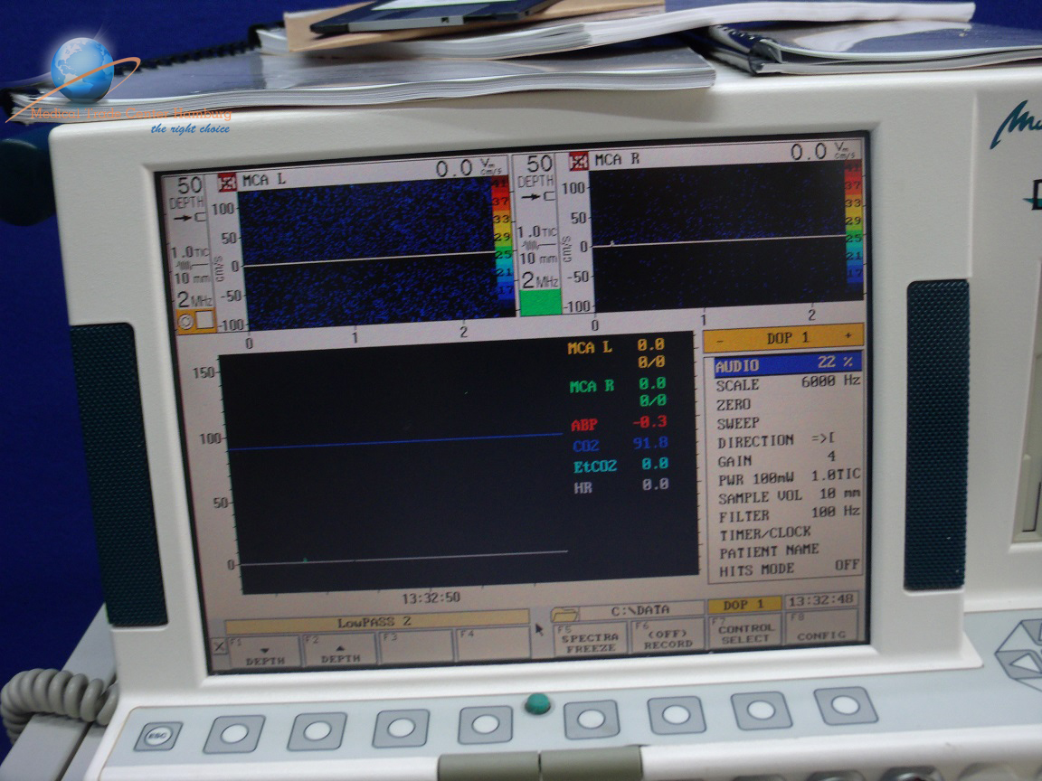 DWL – Multi Flow Doppler mit 03 Stiftsonden