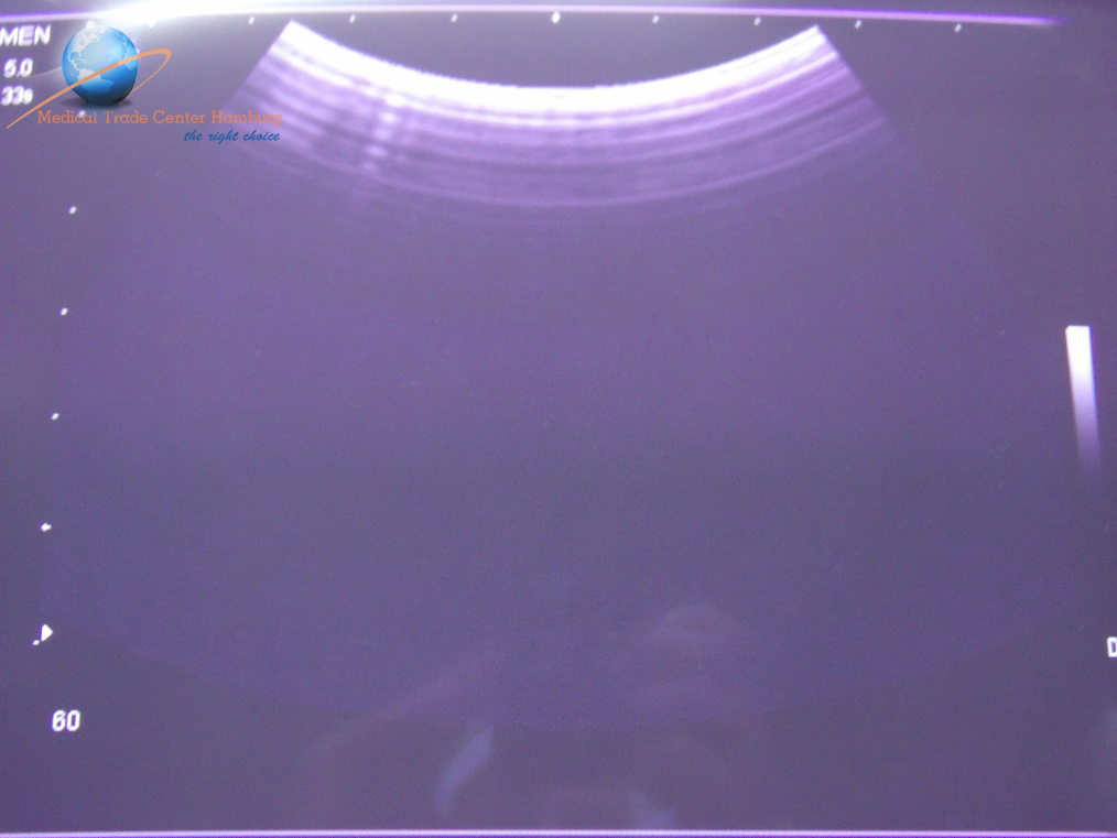 Siemens Sonoline C5-2 Convex Probe für die G Serie, G50, G60