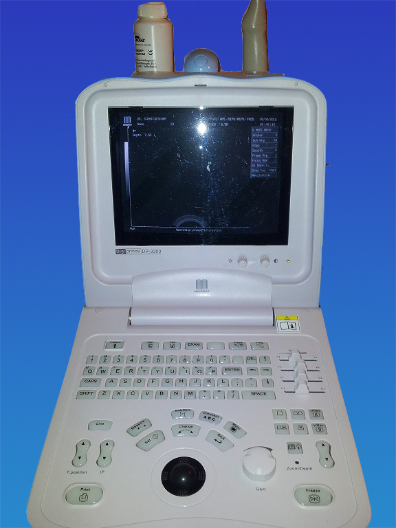 Ultraschallgerät Mindray DP-3300 s/w mit 1 Vaginalsonde