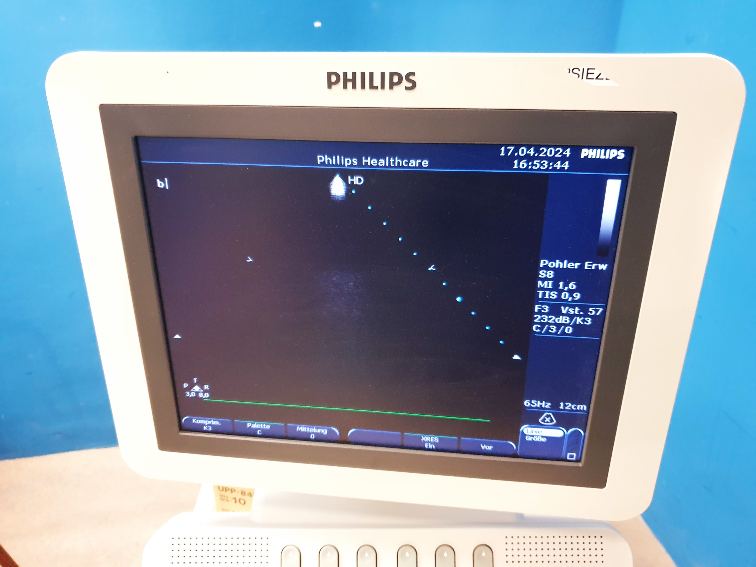 Philips S8 Sektor Ultraschallsonde