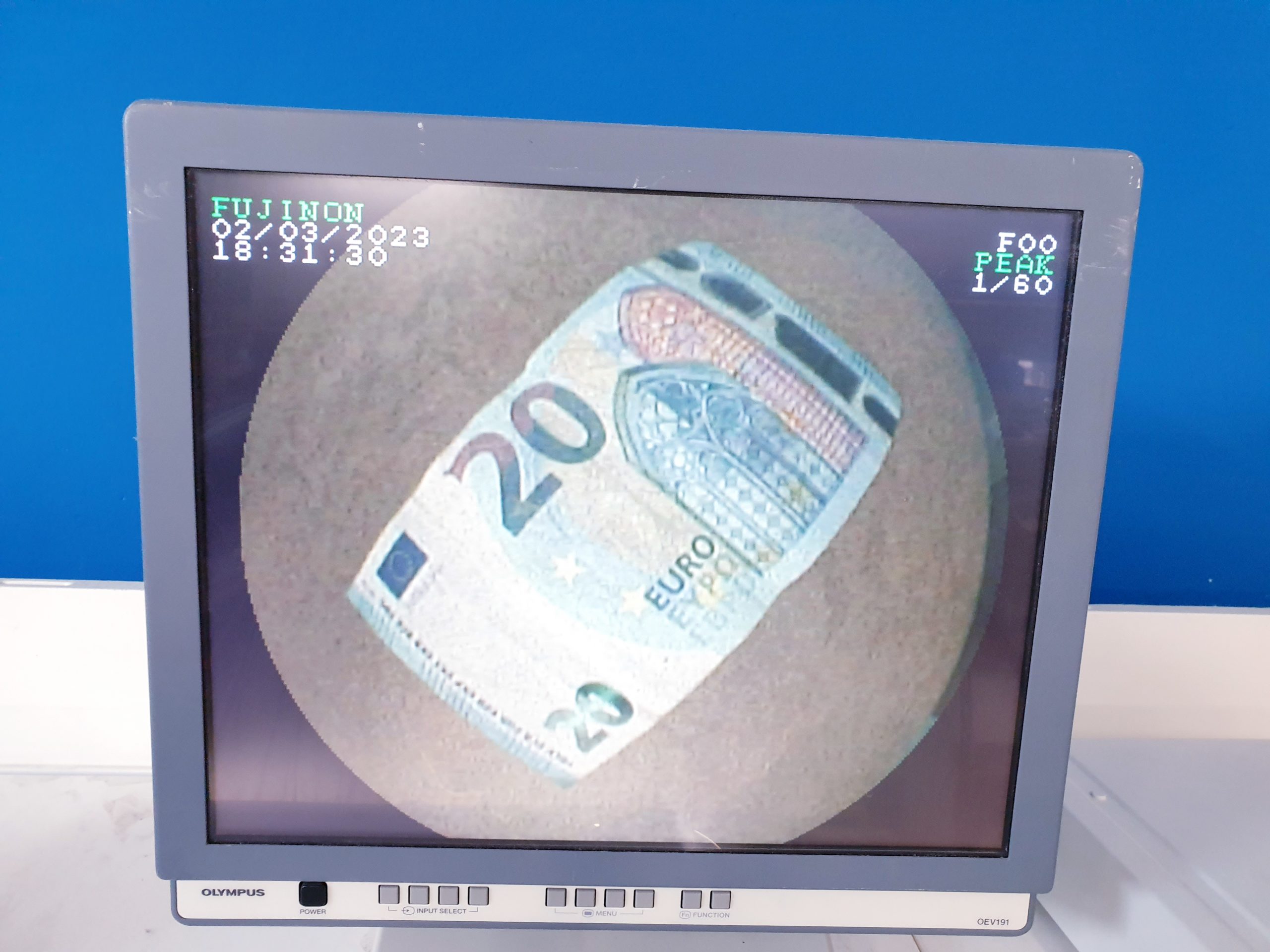 Fujinon EG-530 UR2 Radialscan Ultraschall Endoskop