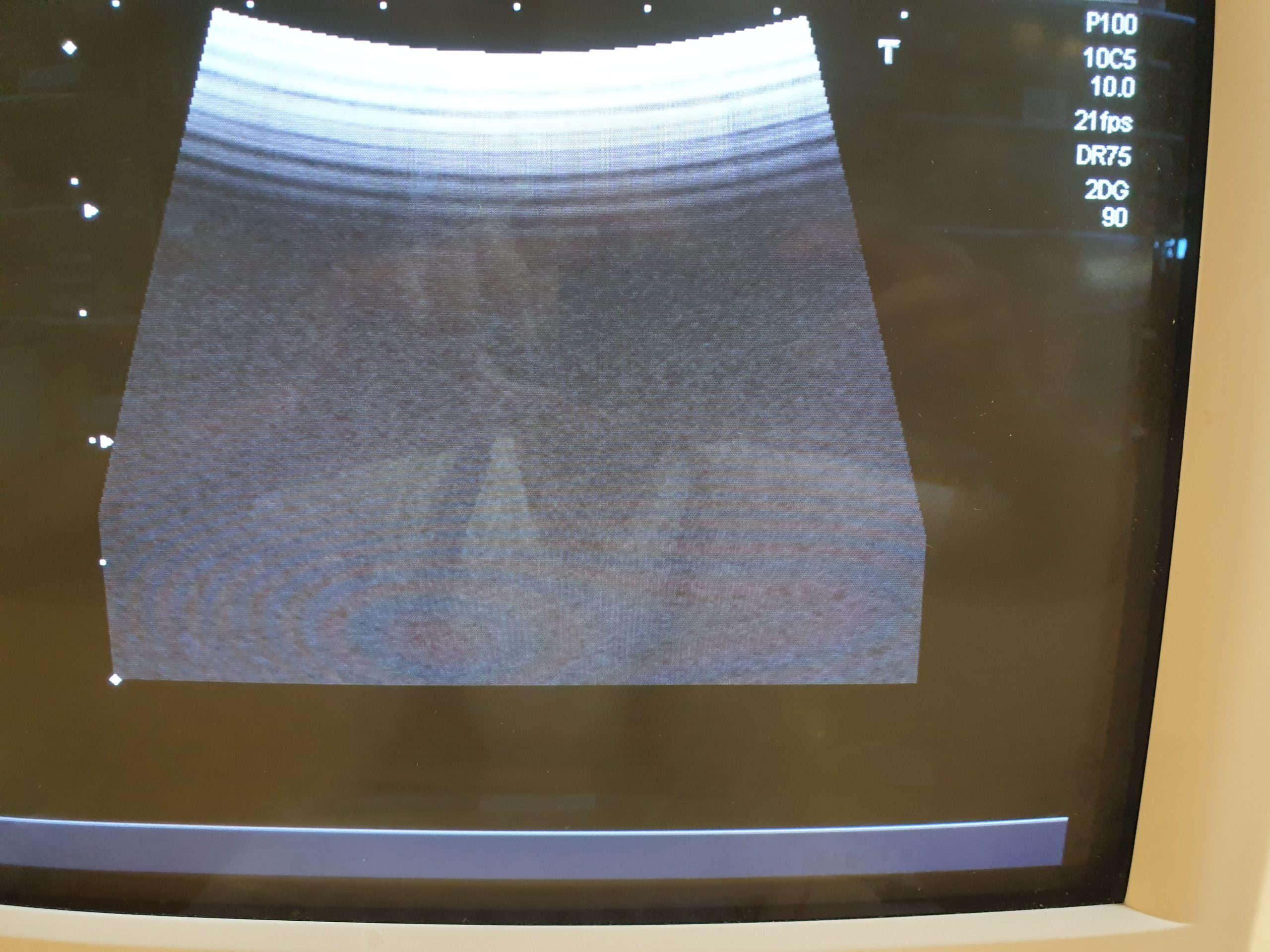 Toshiba PVF-738F Intraoperative Convex Probe