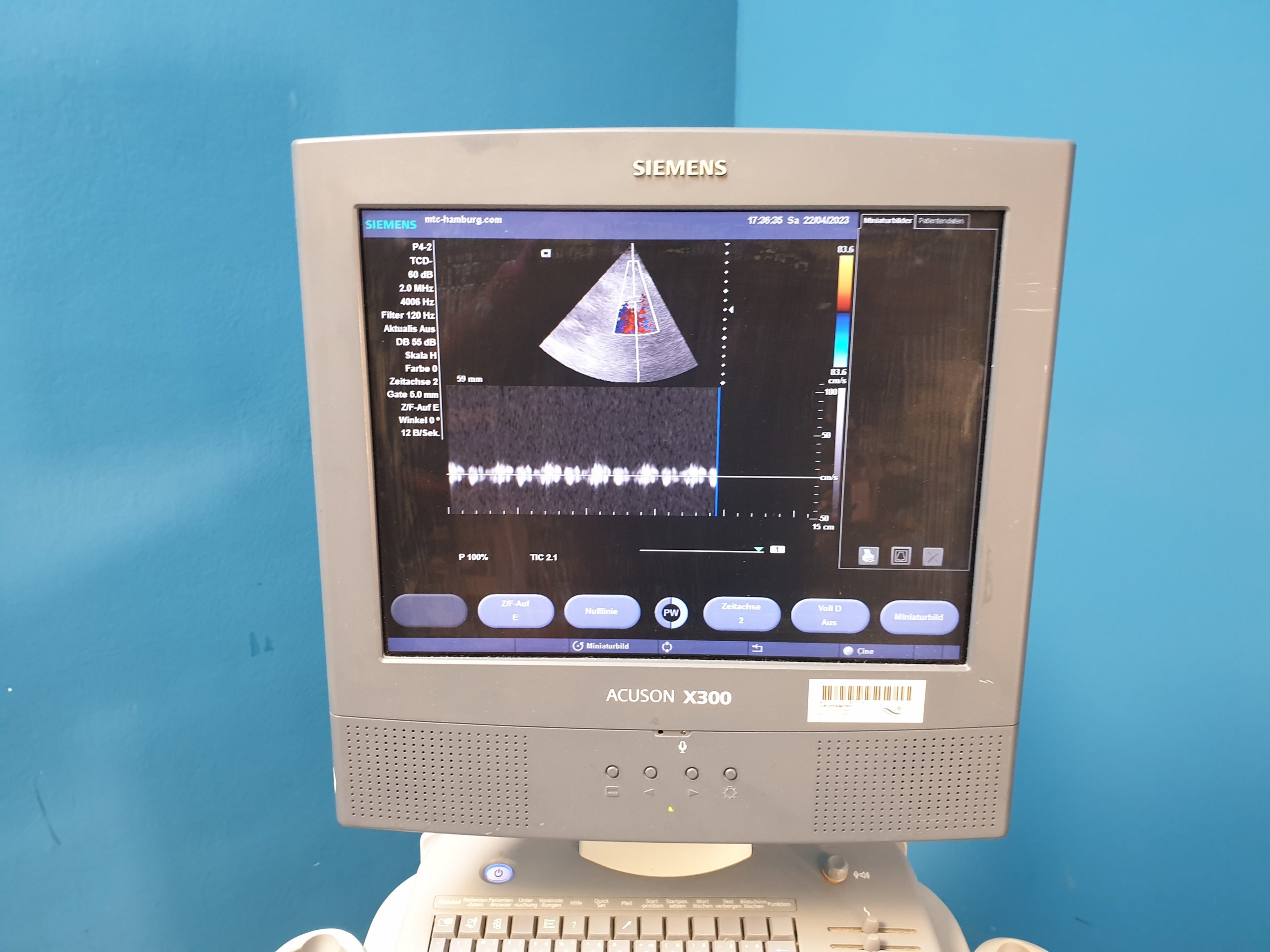 SIEMENS Acuson X300 // X 300 , CH5-2+ VF8 + 3 P4-2 Doppler , …