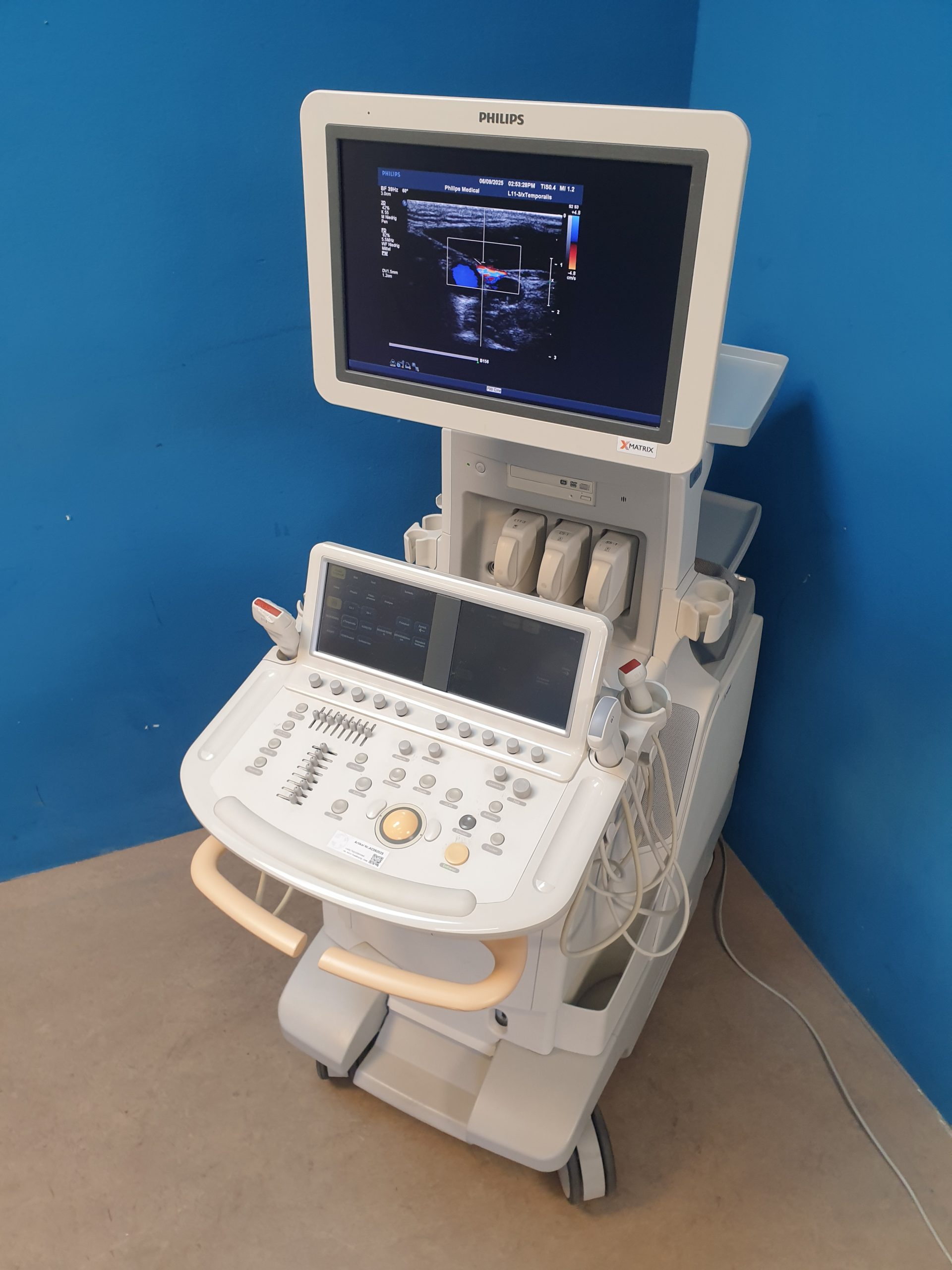 Philips iE33 – IE33 + S5-1 Echo + L11-3 Linear Sonde + Kardiomaschine + C5-1 Konvex Kardio Ultraschallgerät