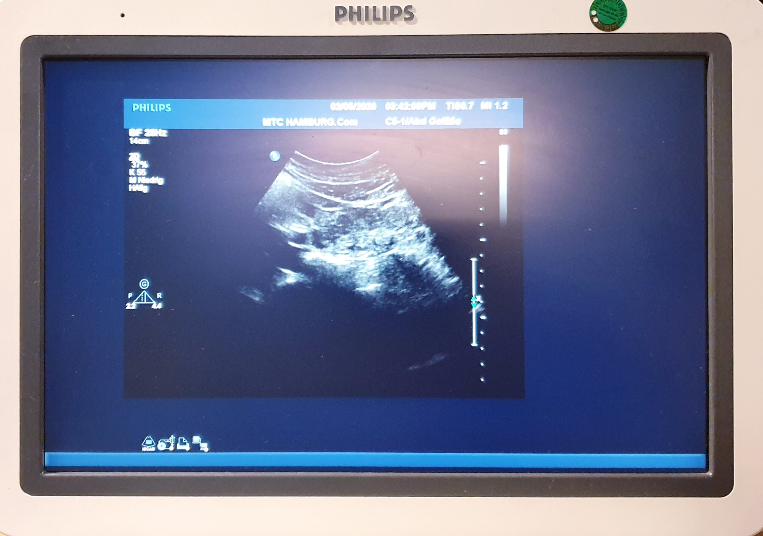 Philips C5-1 PureWave Breitband-Convex-Schallkopf Konvex