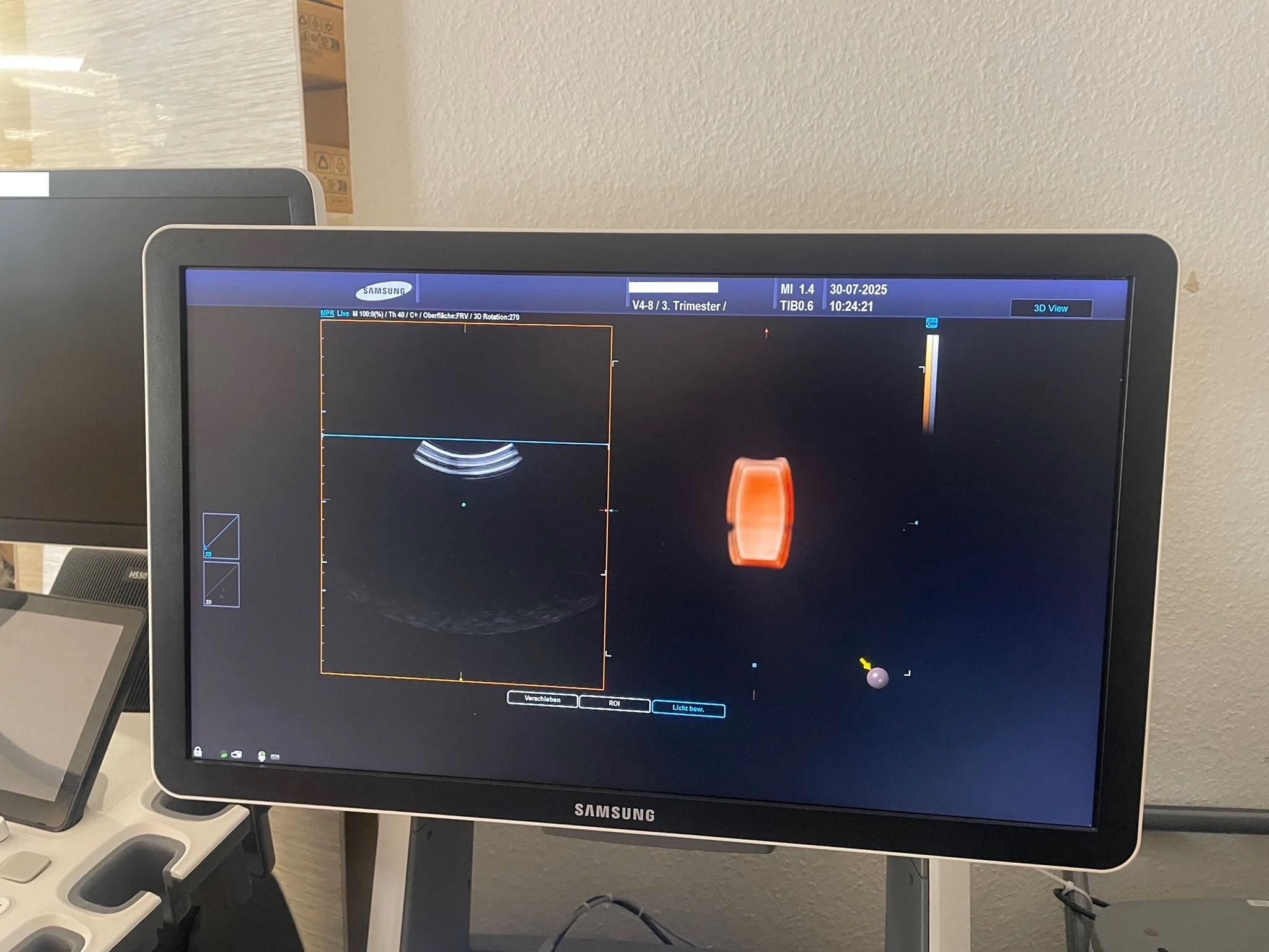 Samsung V4-8 4D Konvexsonde 3D/4D Volumensonde